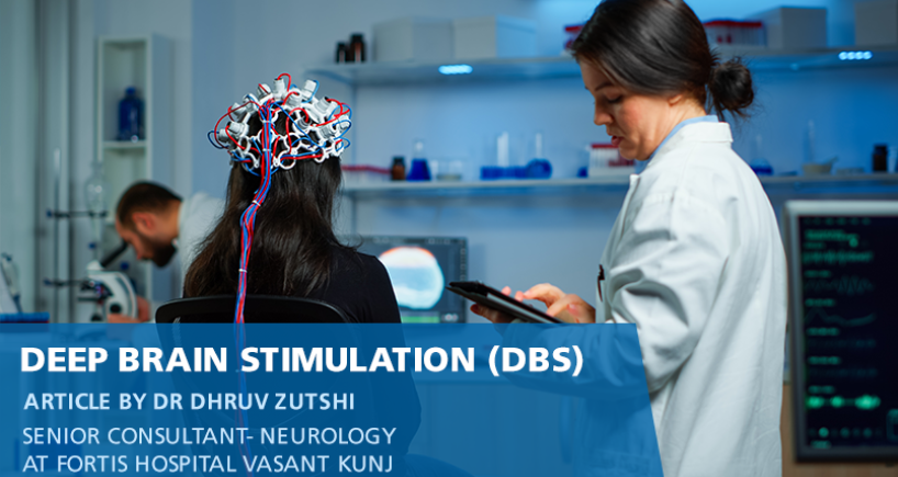 Deep Brain Stimulation