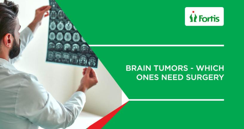 Brain Tumours | Which ones need surgery