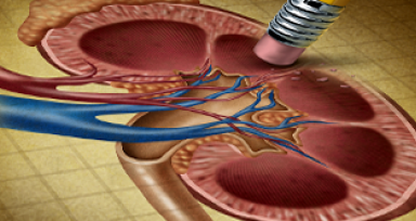 Chronic Kidney Disease: An Emerging Epidemic